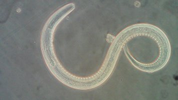 Hookworm larva under a microscope