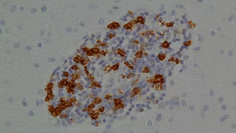 b lymphocytes under a microscope